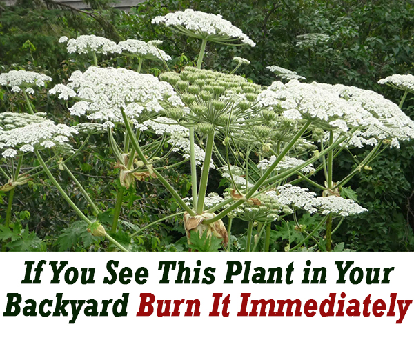 If you see this plant in your Backyard, Burn it immediately